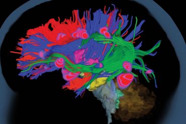 A colorful composite image of a child's brain, produced by the MEG machine at I-LABS